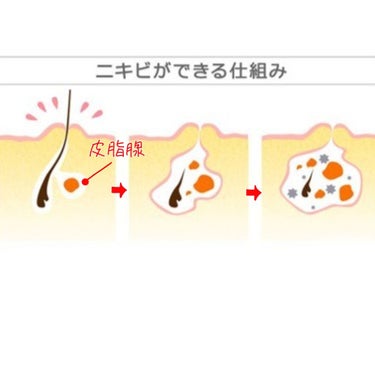 ハトムギ化粧水(ナチュリエ スキンコンディショナー R )/ナチュリエ/化粧水を使ったクチコミ（2枚目）