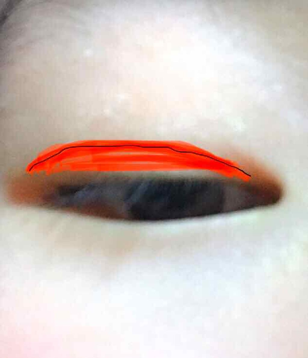 【旧品】オリシキ アイリッドスキンフィルム/D-UP/二重まぶた用アイテムを使ったクチコミ（2枚目）