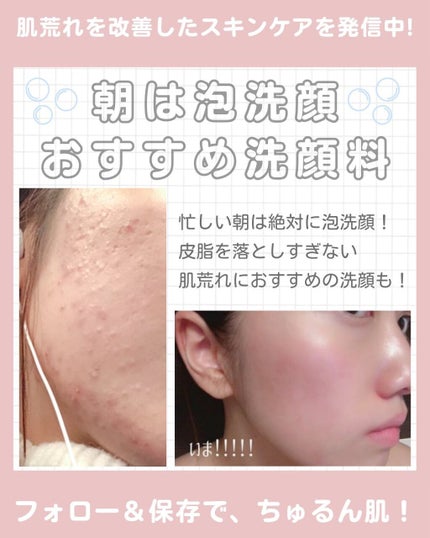 を使ったクチコミ(1枚目)