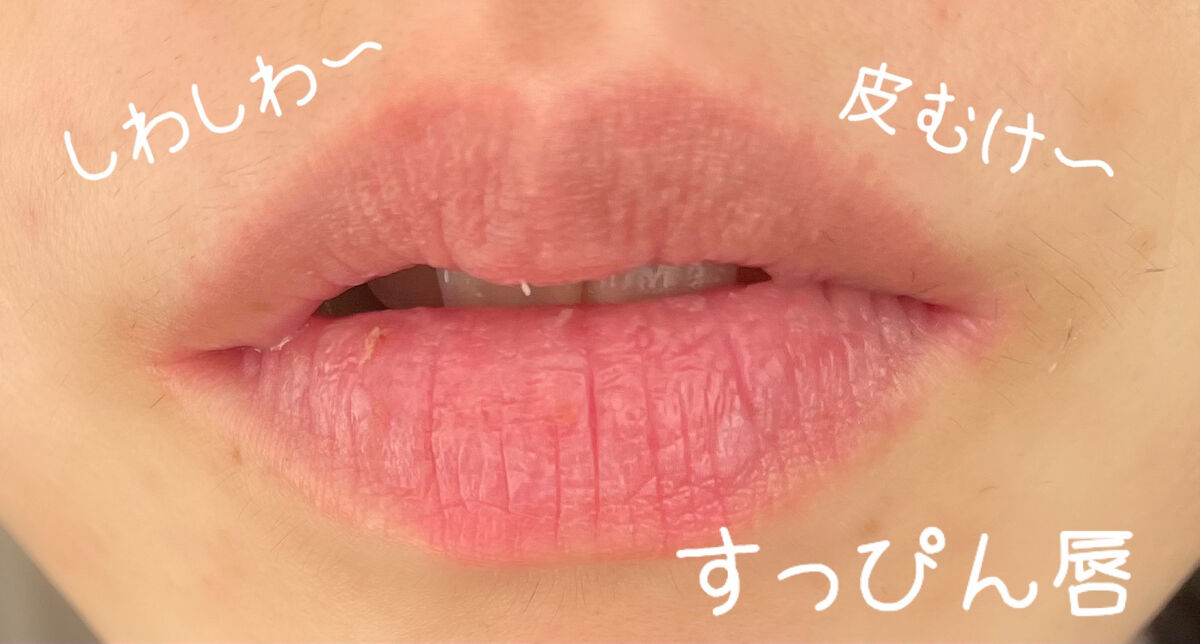 エッセンス リッププランパー/Visée/リッププランパーを使ったクチコミ（2枚目）