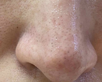 ホホバオイル/無印良品/ボディオイルを使ったクチコミ(2枚目)