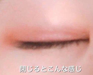 DODODO on LIPS 「しばらく前に二重整形(埋没三点)をしました。私自身情報収集に苦..」（3枚目）