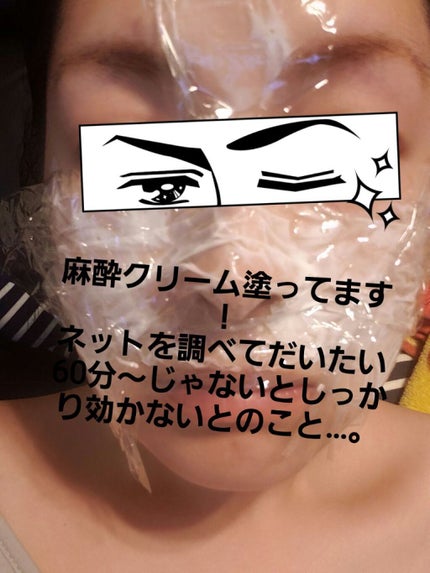 ダーマペン・ダーマスタンプ/MyM/その他スキンケアグッズを使ったクチコミ(4枚目)