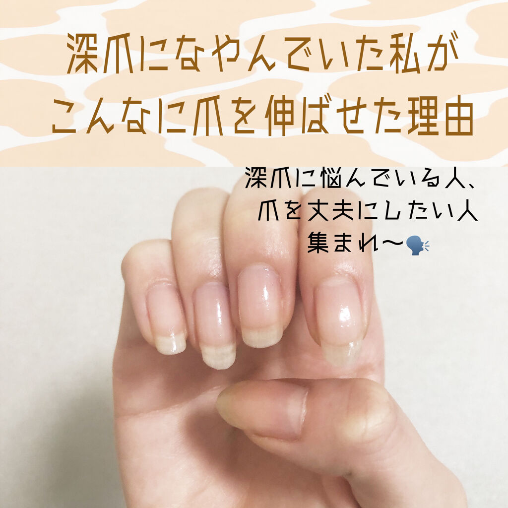 ネイルエンビー/O・P・I/ネイルオイル・トリートメントを使ったクチコミ（1枚目）