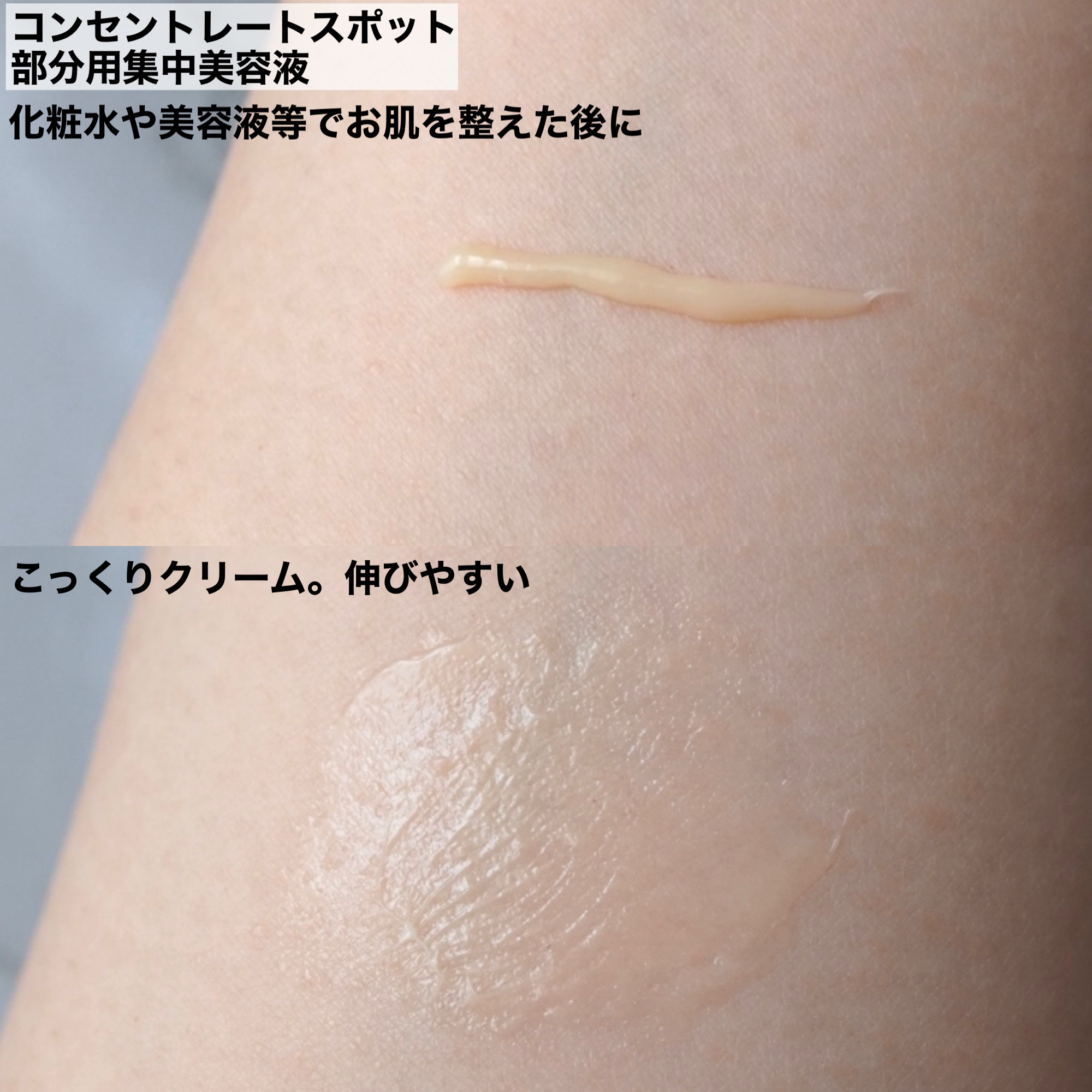 薬用メディショット エッセンスローション/MEDI SHOT/化粧水を使ったクチコミ（3枚目）