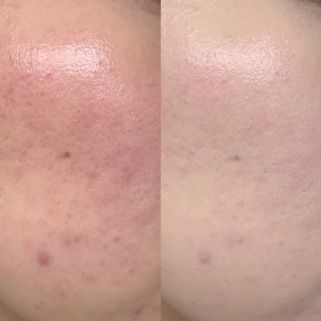 ハグクッション/mude./クッションファンデーションを使ったクチコミ（3枚目）