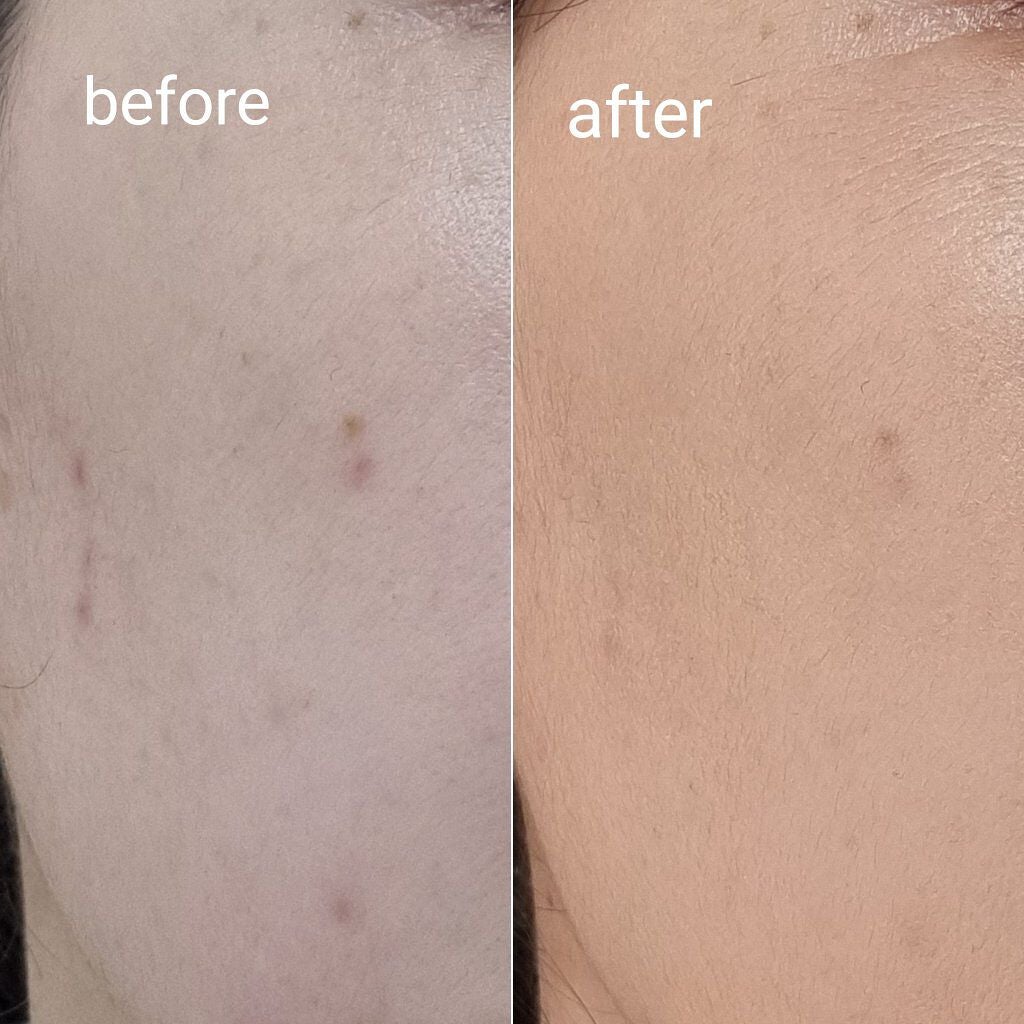 シルキーステイファンデーション/HERA/リキッドファンデーションを使ったクチコミ(3枚目)