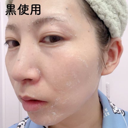 白米ピールショットゴマージュアンプル/Dr.Melaxin/美容液を使ったクチコミ(7枚目)