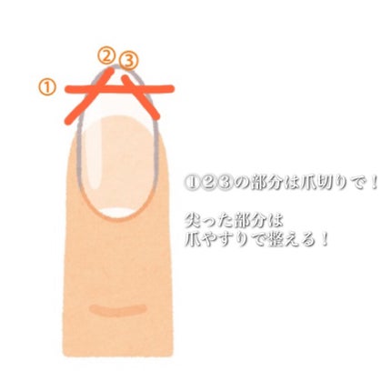 アボプレックス オイル/O・P・I/ネイルオイル・トリートメントを使ったクチコミ(6枚目)