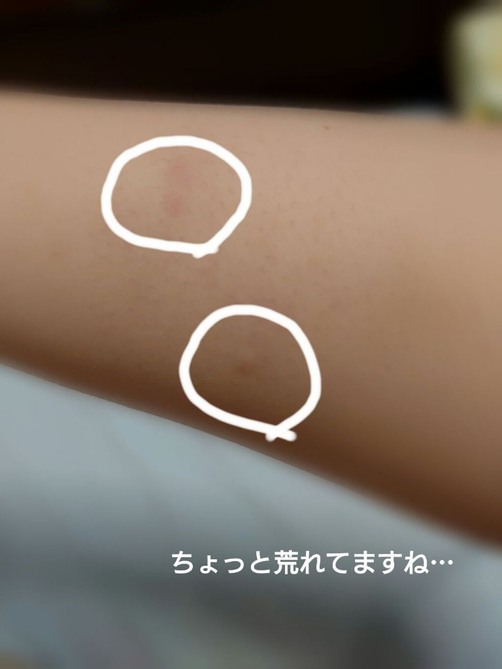 除毛クリーム シトラスホワイトリリィ/スリンキータッチ セルフスパ/除毛クリームを使ったクチコミ（2枚目）