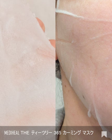 THE ティーツリー 365 カーミングマスク/MEDIHEAL/シートマスク・パックを使ったクチコミ(5枚目)
