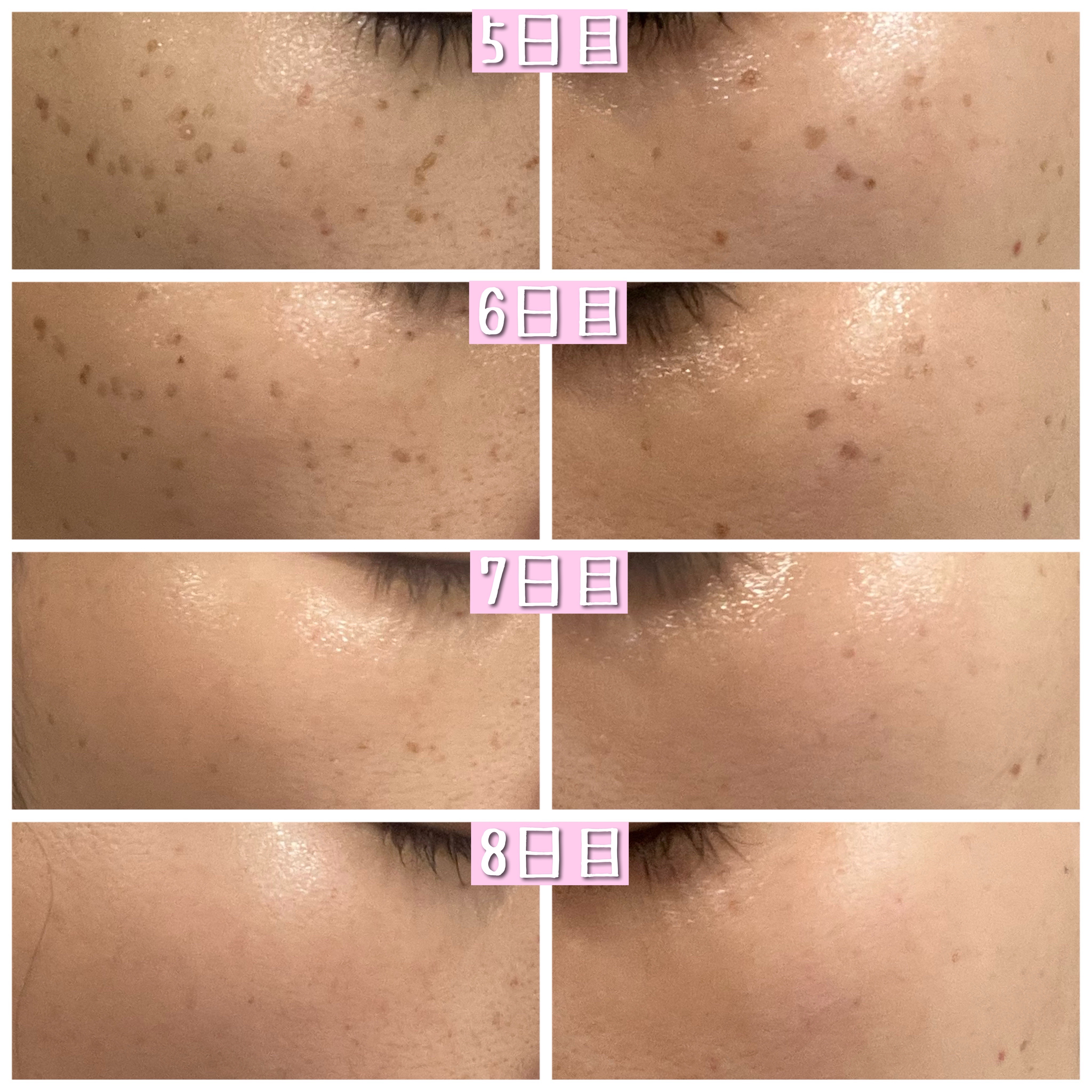 スキンブライセラム/ZO Skin Health/美容液を使ったクチコミ（3枚目）