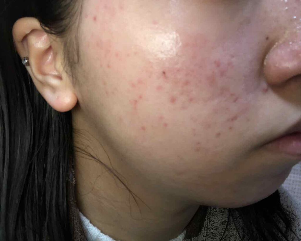 ウォッシャブル コールド クリーム/ちふれ/クレンジングクリームを使ったクチコミ（2枚目）