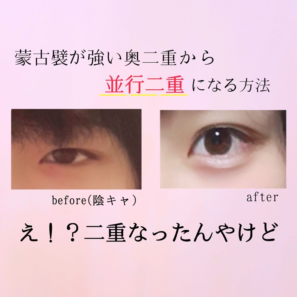 ニベアクリーム/ニベア/ボディクリームを使ったクチコミ（1枚目）