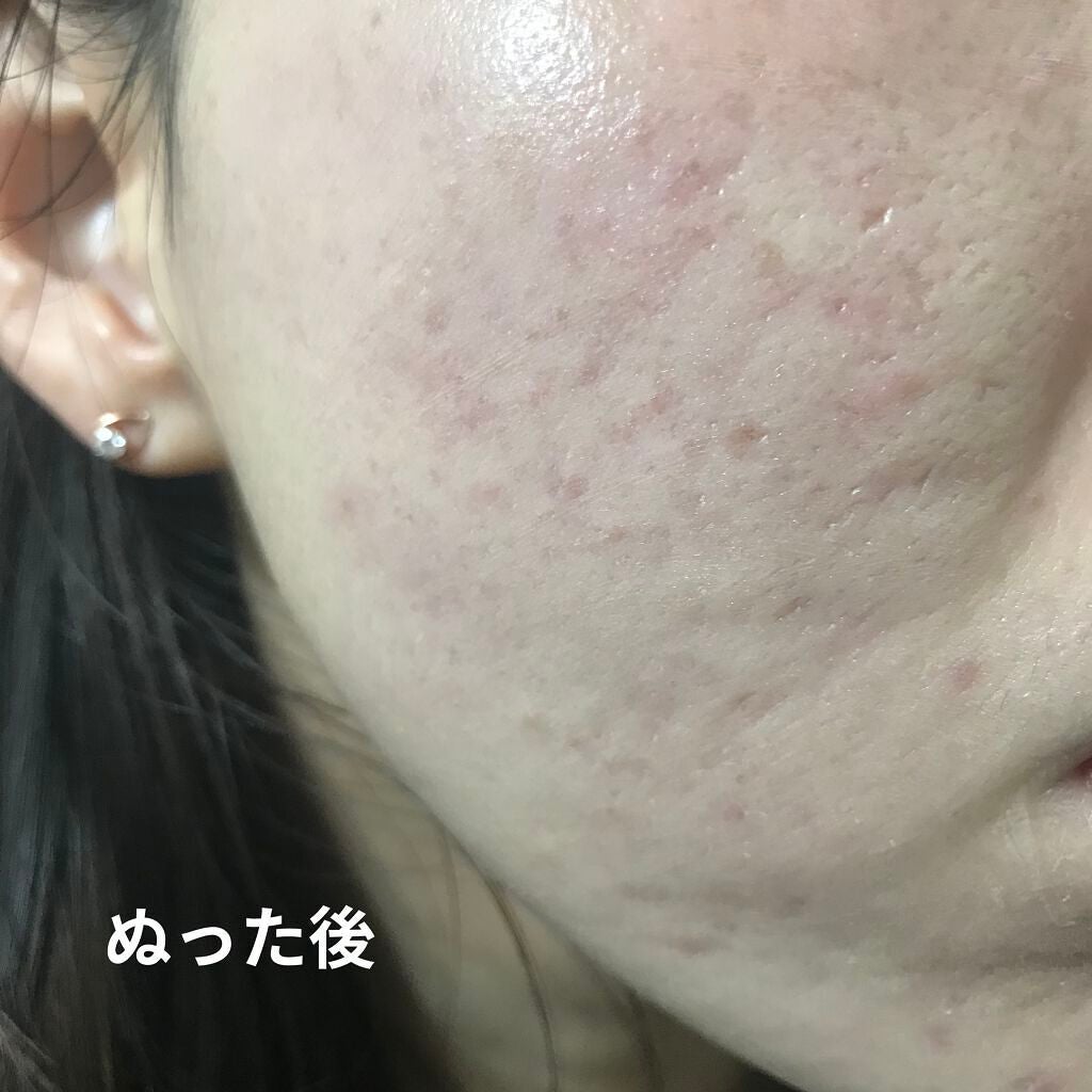 ドクタージャルト シカペア リカバー (第2世代)/Dr.Jart+/フェイスクリームを使ったクチコミ(4枚目)