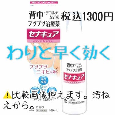 セナキュア(医薬品)/小林製薬/その他を使ったクチコミ（1枚目）