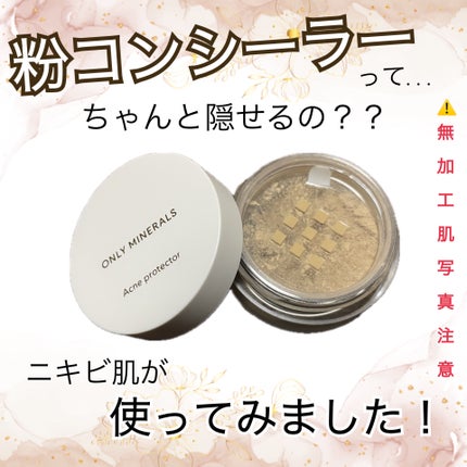 薬用コンシーラー アクネプロテクター/ONLY MINERALS/パウダーコンシーラーを使ったクチコミ(1枚目)