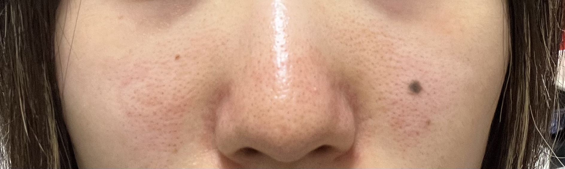 ビタペアC ダークスポットセラム/ネイチャーリパブリック/美容液を使ったクチコミ（2枚目）