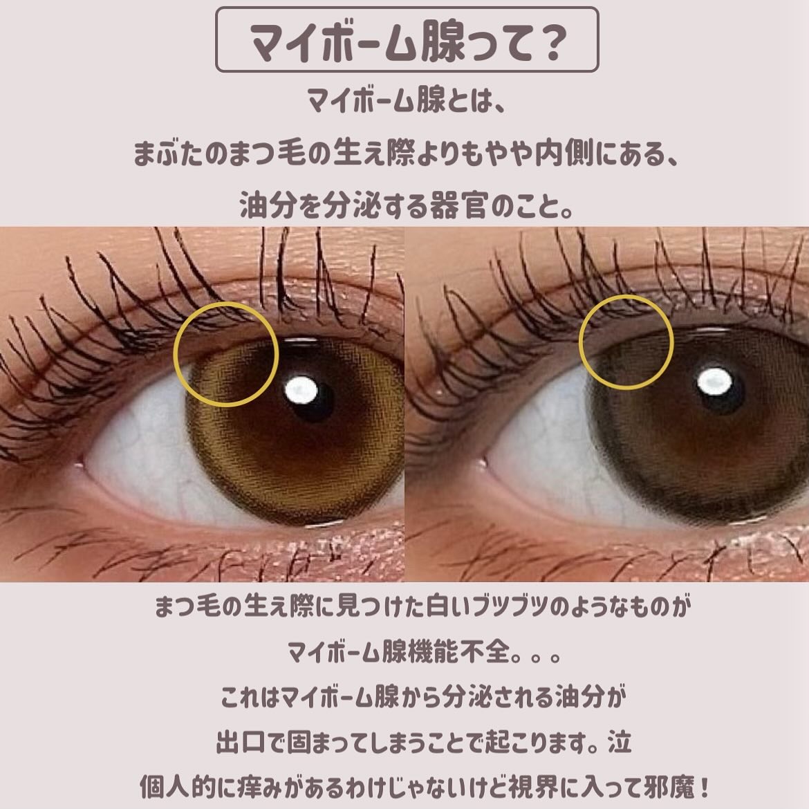 アイシャンプーロング/メディプロダクト/その他洗顔料を使ったクチコミ（2枚目）