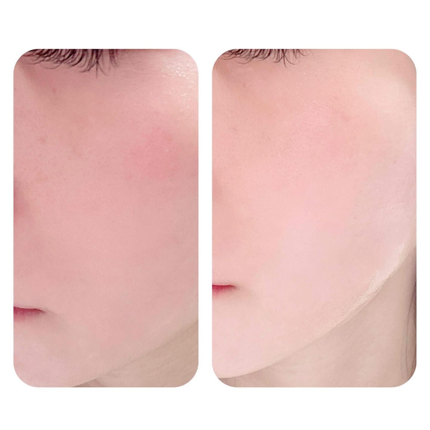 LENA on LIPS 「.▷COSNORI(@cosnori_jp)PDRN-SHOT..」(5枚目)