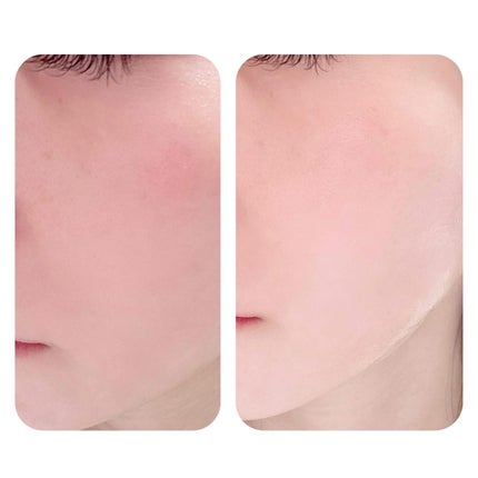 LENA on LIPS 「.▷COSNORI(@cosnori_jp)PDRN-SHOT..」(5枚目)