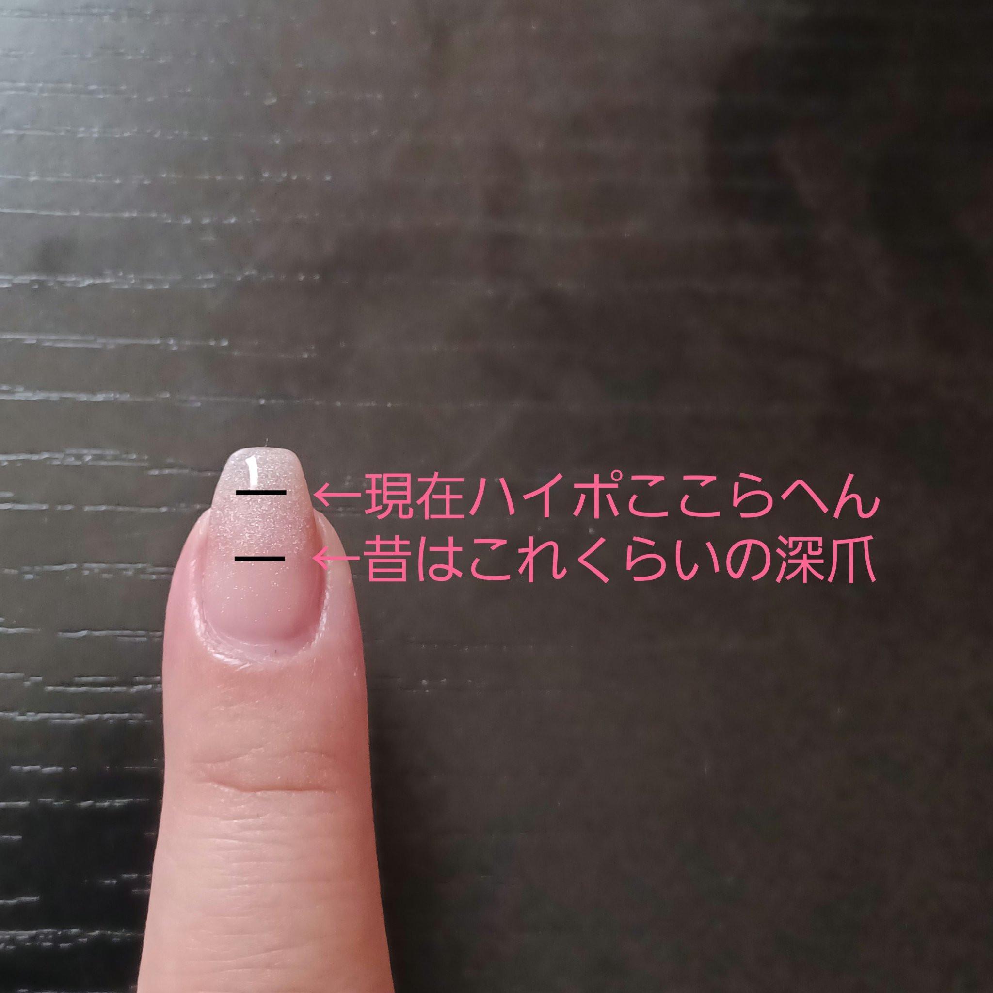 ウィンマックス キューティクルオイル/DAISO/ネイルオイル・トリートメントを使ったクチコミ（2枚目）