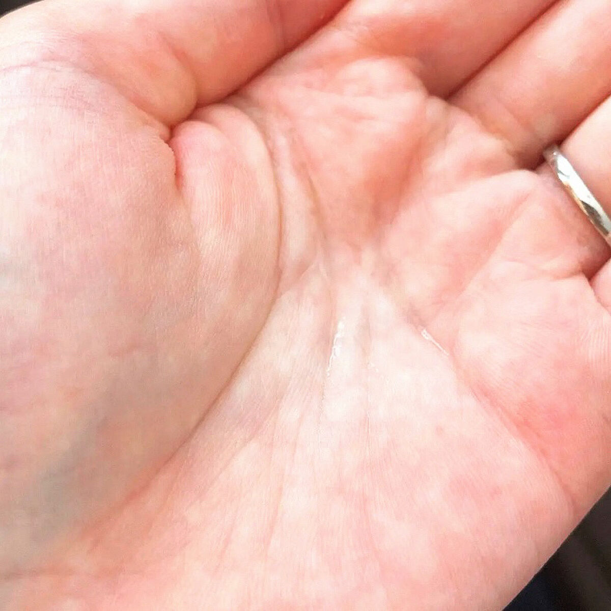 GC フェイシャルエッセンス/ジェネリック化粧品/化粧水を使ったクチコミ（3枚目）