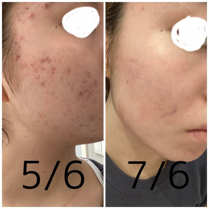 を使ったクチコミ(1枚目)