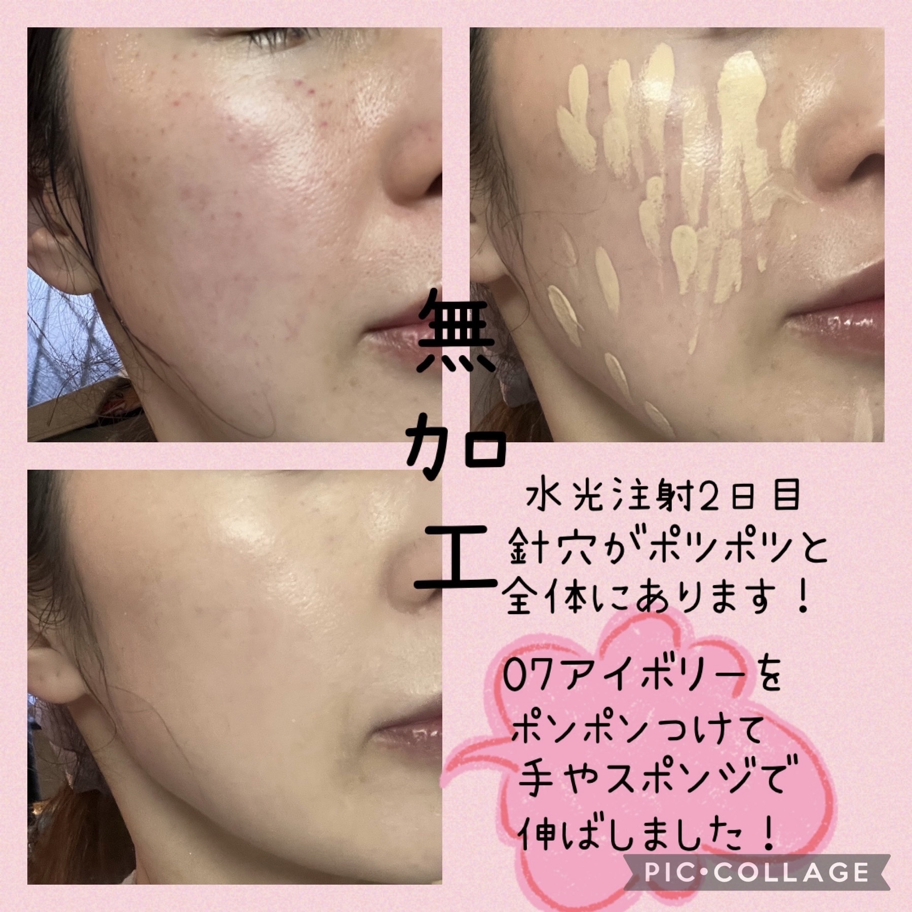 ロングラスティングチップコンシーラー 0.7 アイボリー/LUNA/リキッドコンシーラーを使ったクチコミ（2枚目）