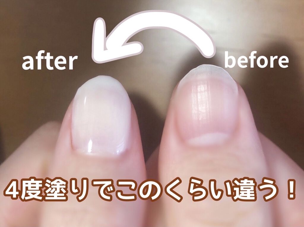 ディーアップファンデーション/D-UP/ネイルベースコートを使ったクチコミ（3枚目）