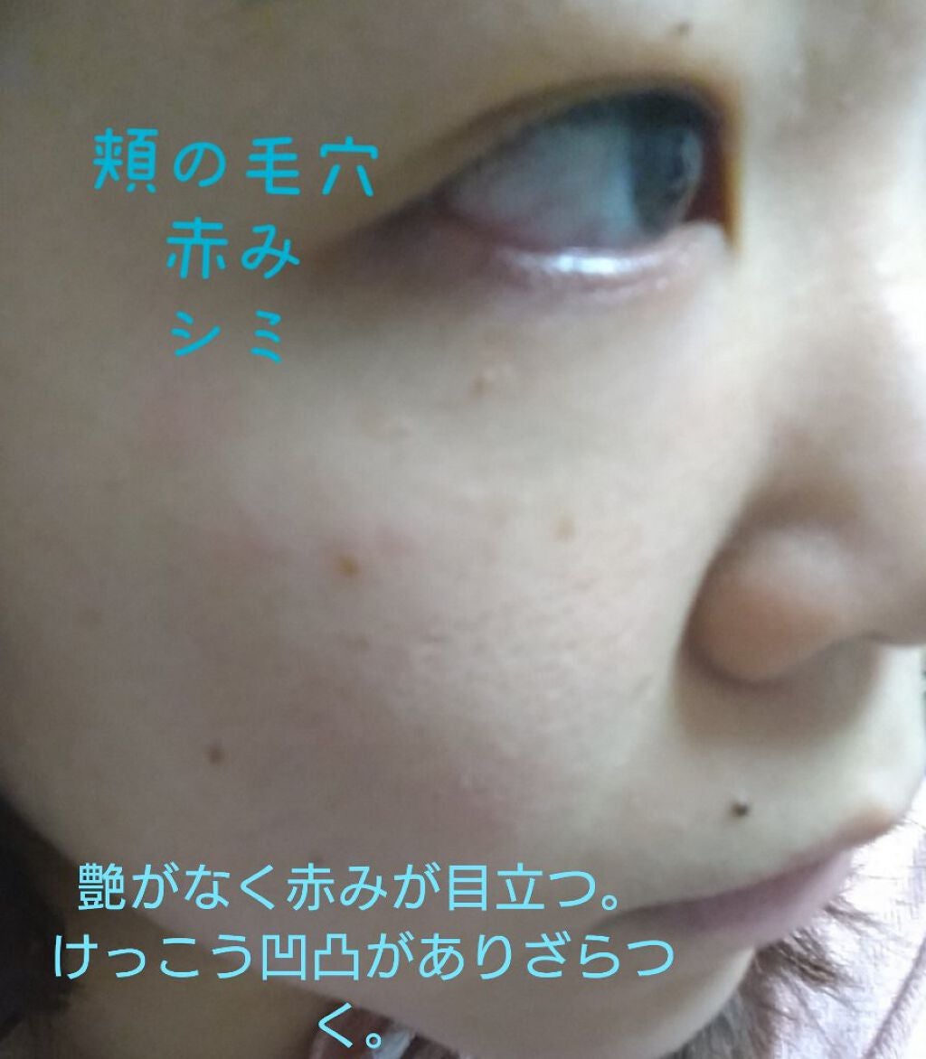 目ざまシート ひきしめタイプ/サボリーノ/シートマスク・パックを使ったクチコミ(2枚目)