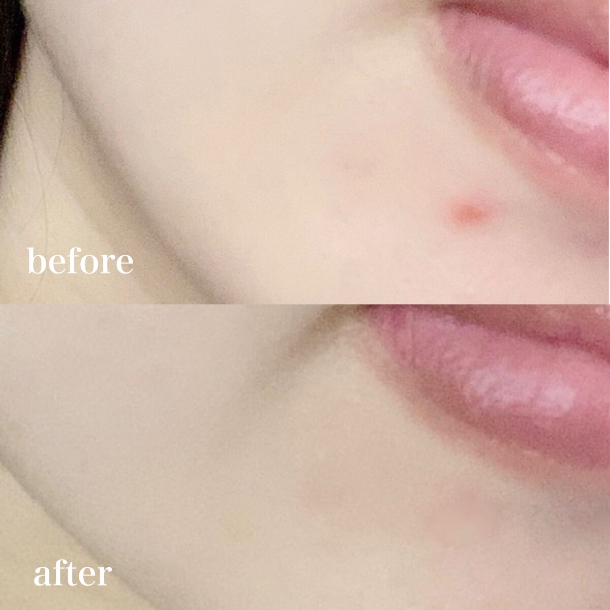 パーフェクト アンプル セラム イドラ/9Wishes/美容液を使ったクチコミ（3枚目）