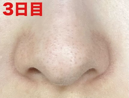 薬用 しみ 集中対策 美容液/メラノCC/美容液を使ったクチコミ(4枚目)