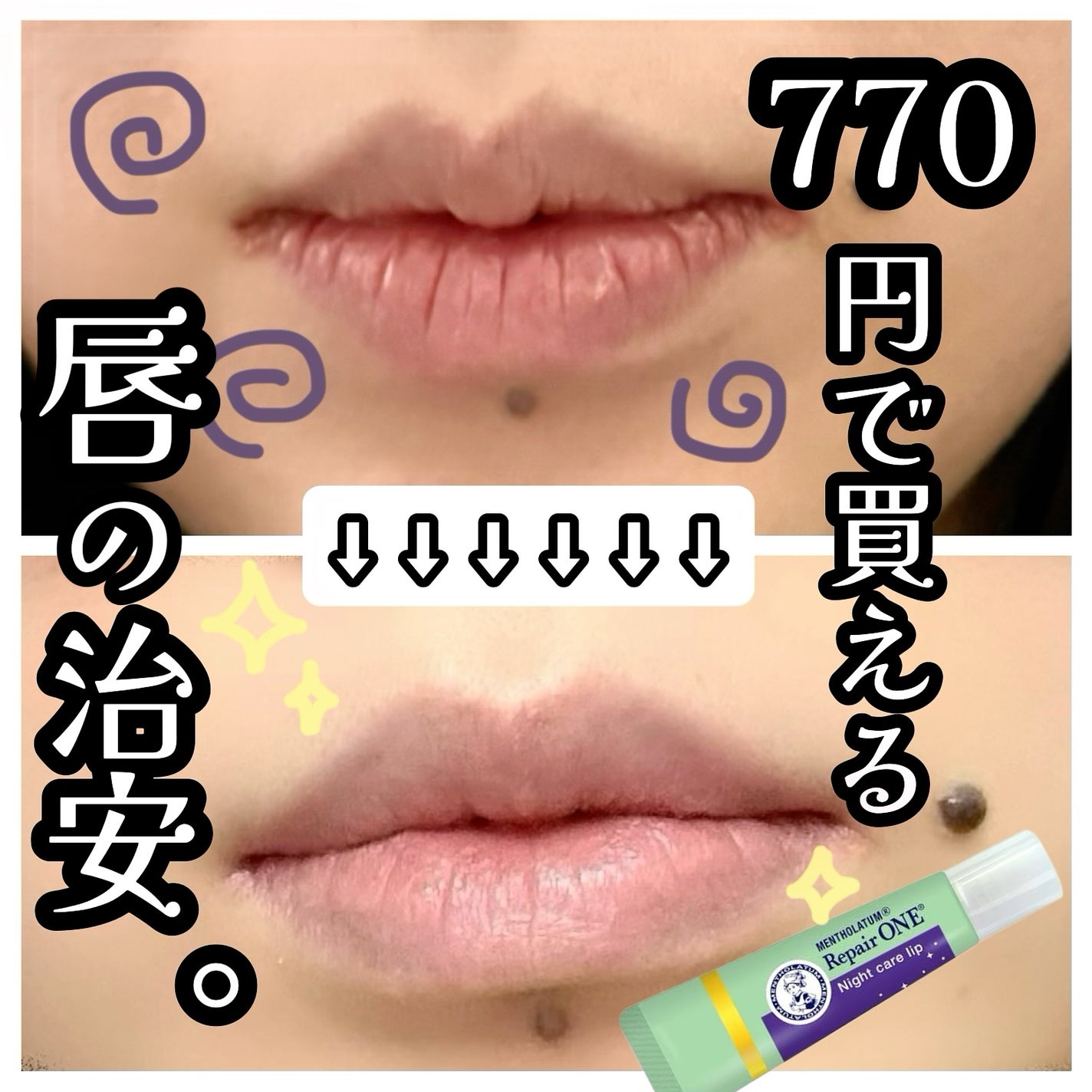 メンソレータム リペアワン ナイトケアリップ/メンソレータム/リップ美容液を使ったクチコミ(1枚目)