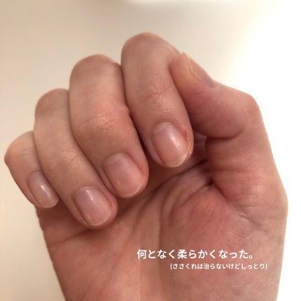 ゆびさき&ネイルケアパック/DAISO/ネイル用品を使ったクチコミ(5枚目)