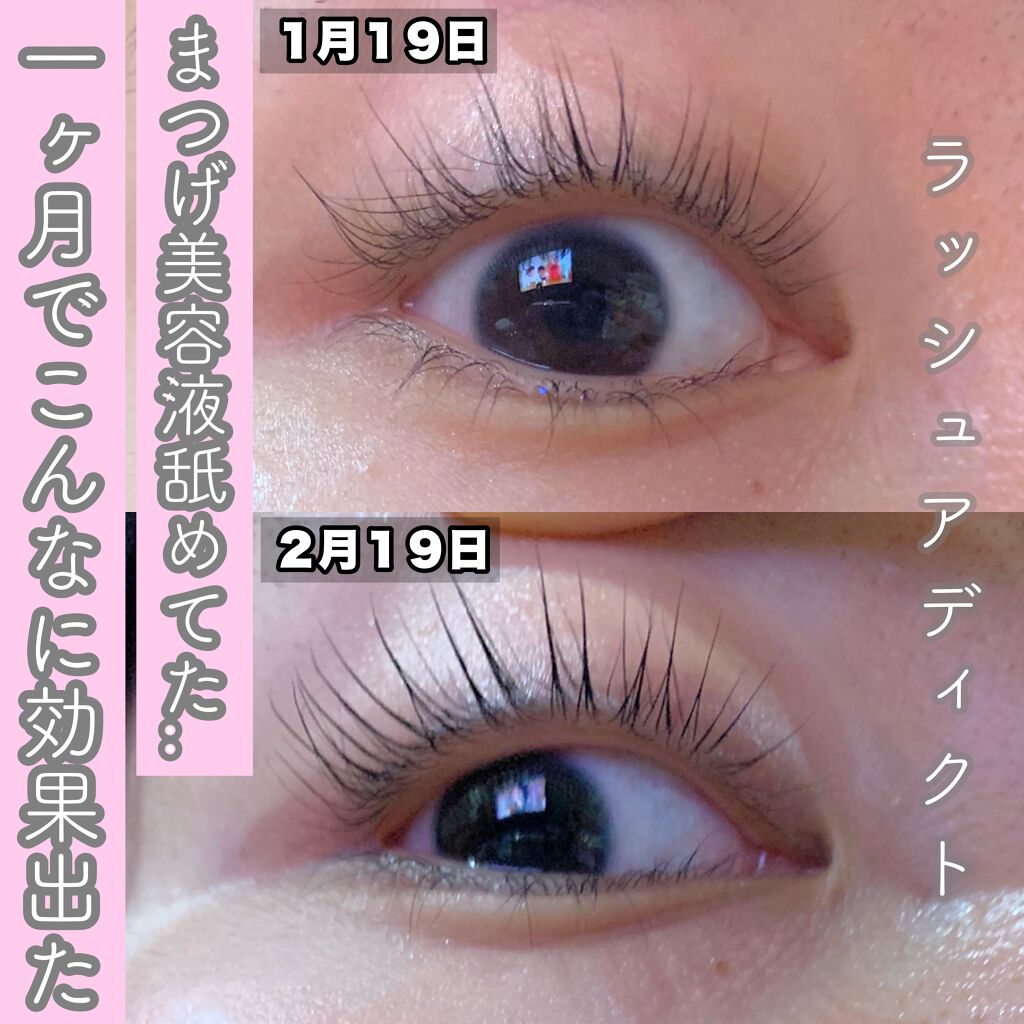 ラッシュアディクト アイラッシュコンディショニングセラム/soaddicted/まつげ美容液を使ったクチコミ(1枚目)