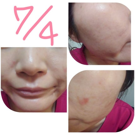 オバジC10セラム/オバジ/美容液を使ったクチコミ(1枚目)