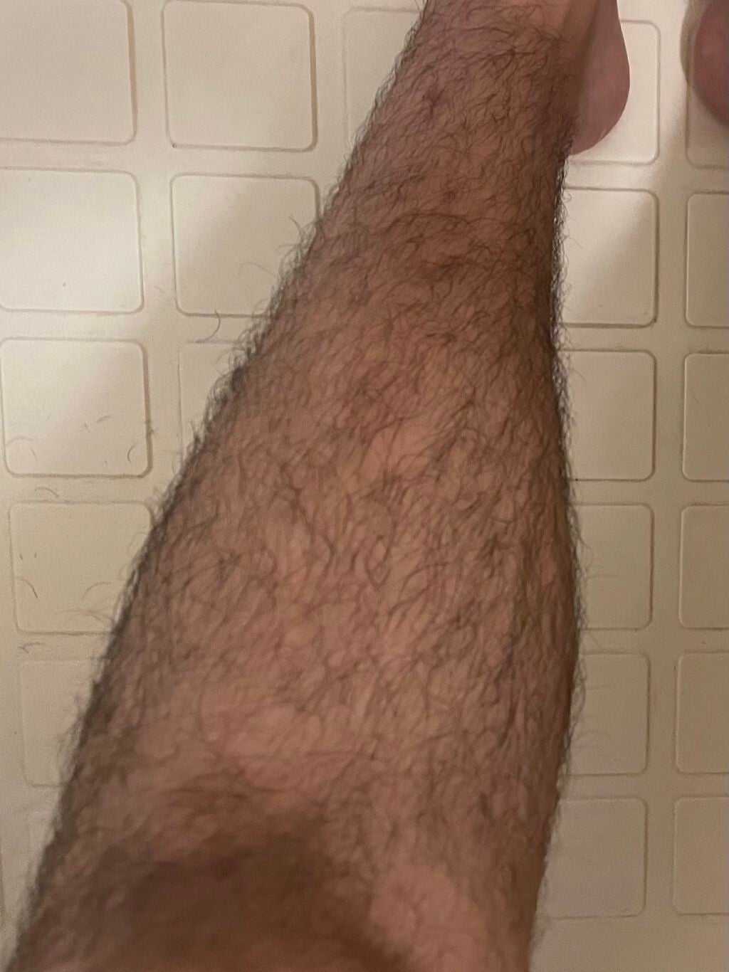 アイスダンディ/notime/家庭用脱毛器を使ったクチコミ(2枚目)