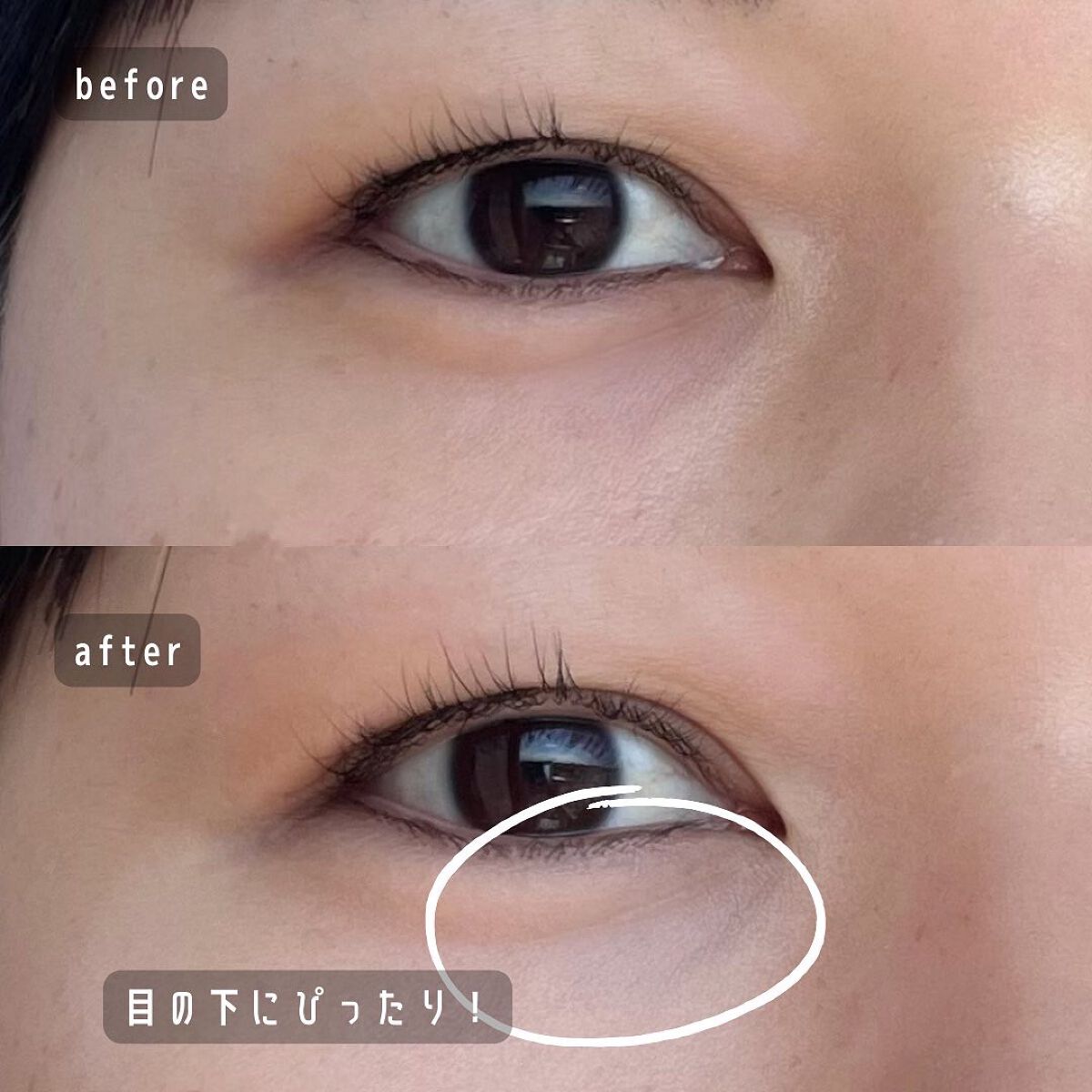 湘南美容コンシーラー/湘南美容/スティックコンシーラーを使ったクチコミ（3枚目）