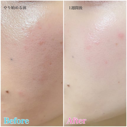 ごんす@YouTube始めました on LIPS 「《ELFACE》昨日YouTube動画でやったやつ、♥️美容大..」(4枚目)