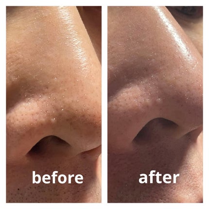 ソフィーナ iP ポア クリアリング ジェル ウォッシュ/SOFINA iP/その他洗顔料を使ったクチコミ(2枚目)