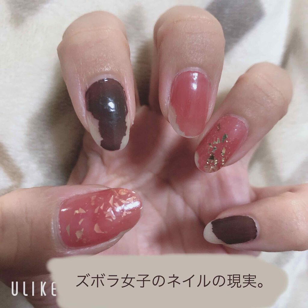 エルファー ネイルキッスA/DAISO/除光液を使ったクチコミ（1枚目）