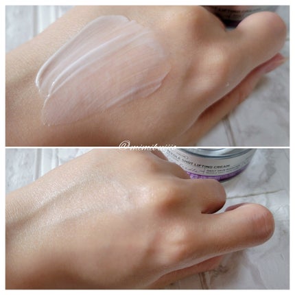 リードルショット100/VT/美容液を使ったクチコミ(8枚目)