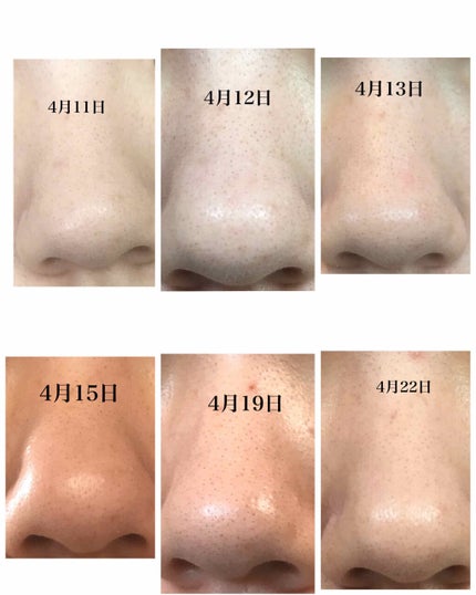 ベビーオイル 無香料/ジョンソンベビー/ボディオイルを使ったクチコミ(3枚目)