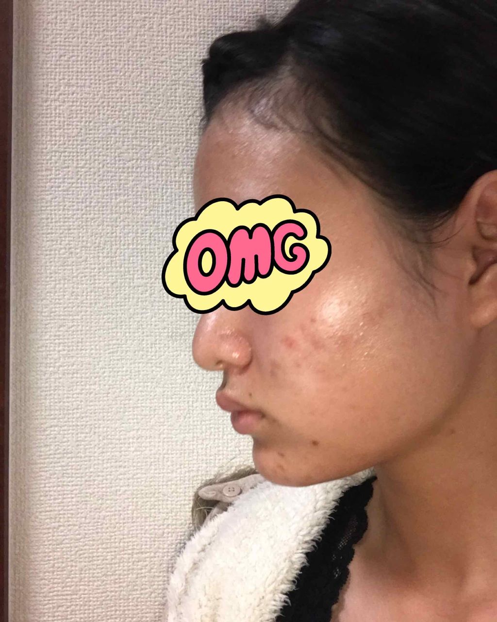 明色美顔水 薬用化粧水/美顔/化粧水を使ったクチコミ(3枚目)