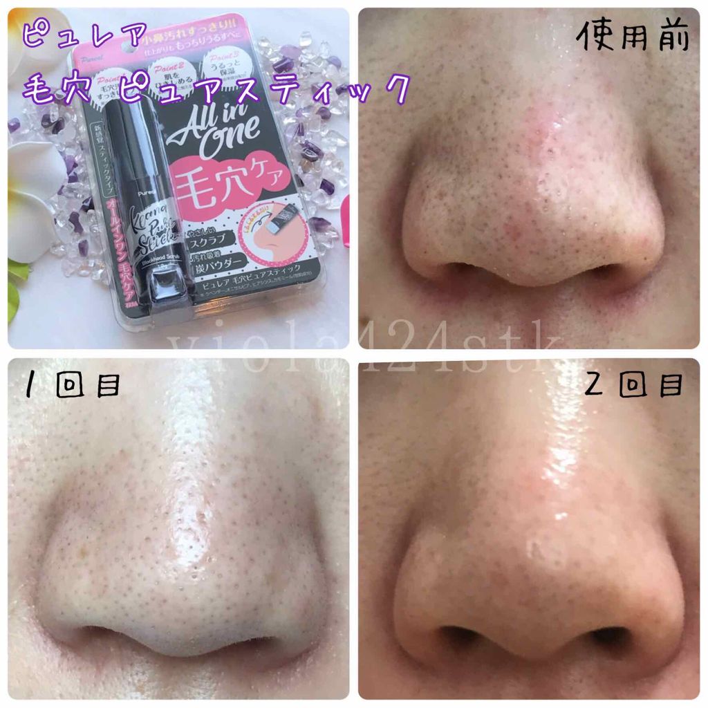 毛穴ピュアスティック/ピュレア/ピーリングを使ったクチコミ（2枚目）