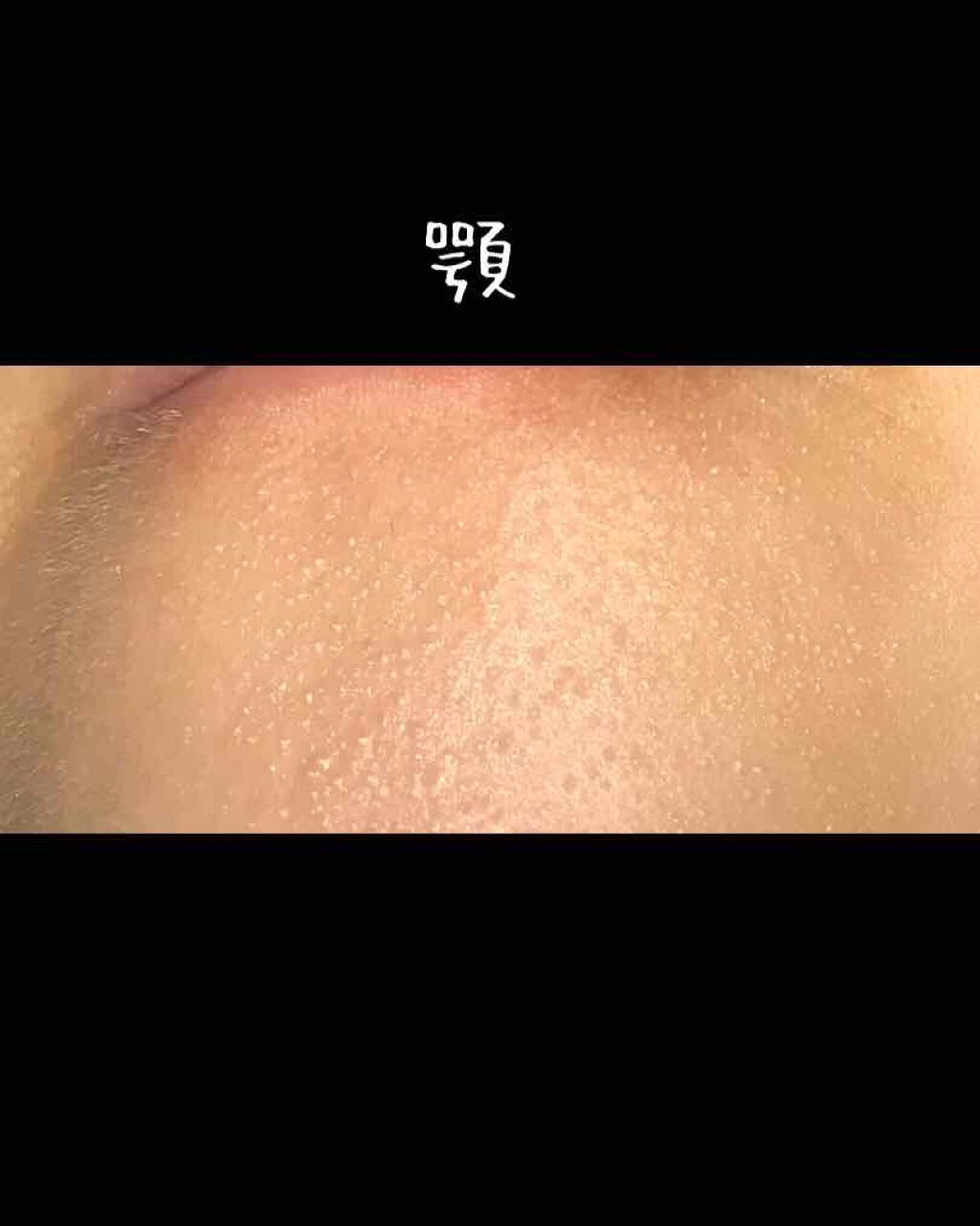 m.yura on LIPS 「写真はノーマスです少し前から鼻やほっぺた、顎、おでこなどにブツ..」(4枚目)