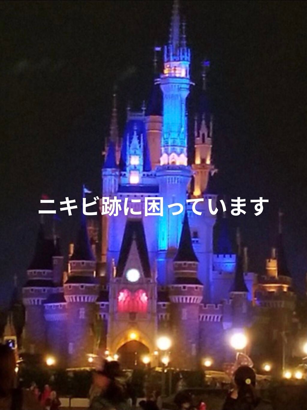 Aoba on LIPS 「私は、だいたいニキビは、おでこにできるんですよ。なので日常では..」(1枚目)