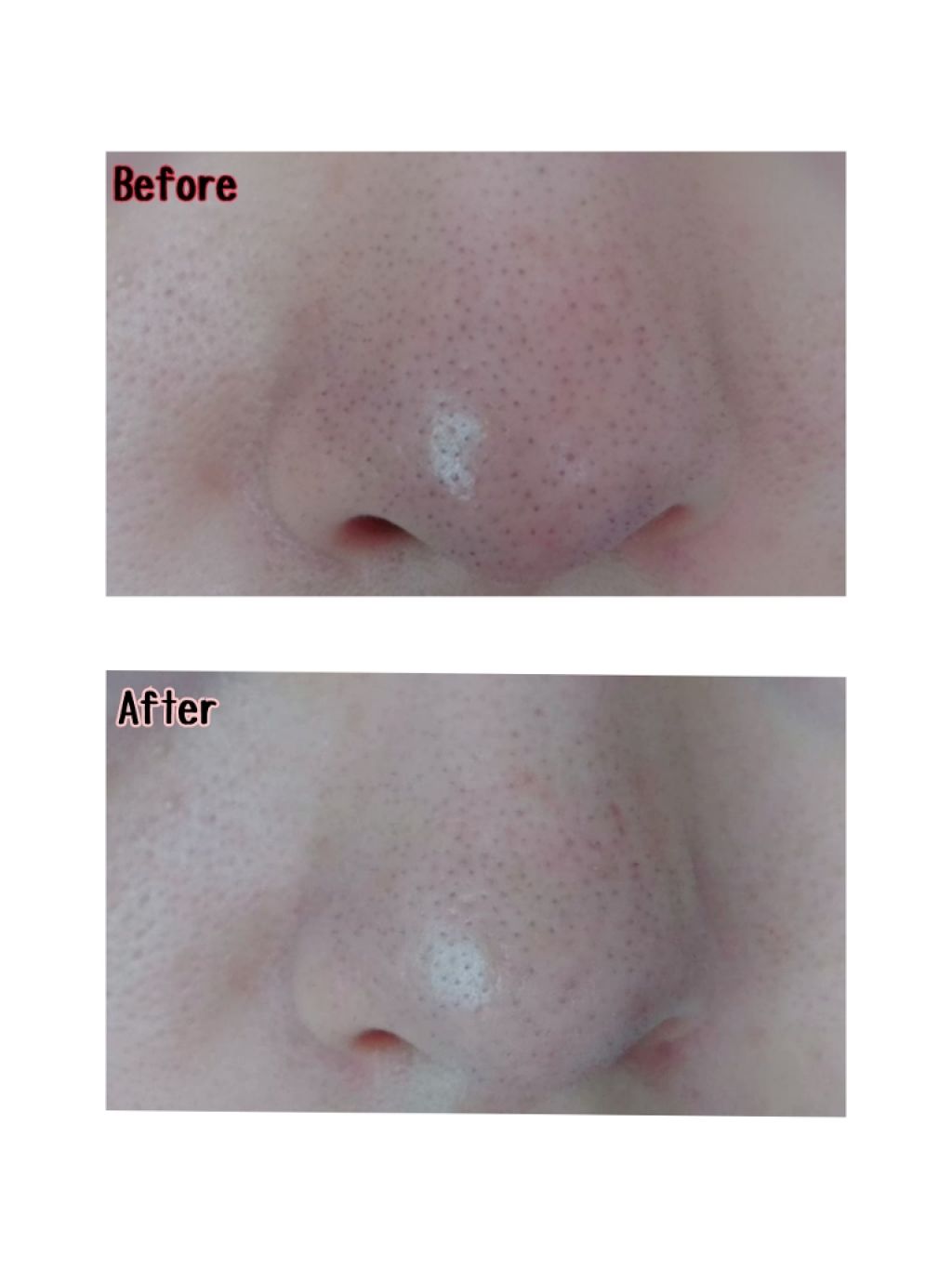 ソワンポアリペアローション/BIRAI IN/化粧水を使ったクチコミ(4枚目)