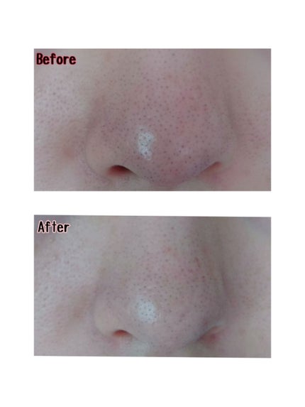 ソワンポアリペアローション/BIRAI IN/化粧水を使ったクチコミ(4枚目)